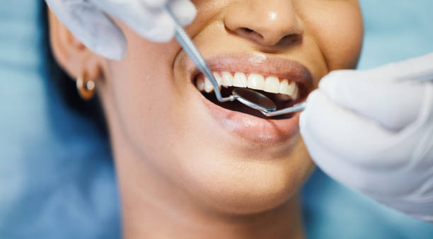 Best Emergency Treatment for Dental Infections or Abscesses in Woodside, CA